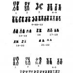 Хромосомные болезни связанные с изменением числа хромосом у человека